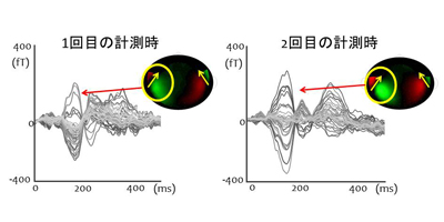 上図の矢印で示した成分が，幼児期に特有であり， 今回，言語発達との関連が認められた成分