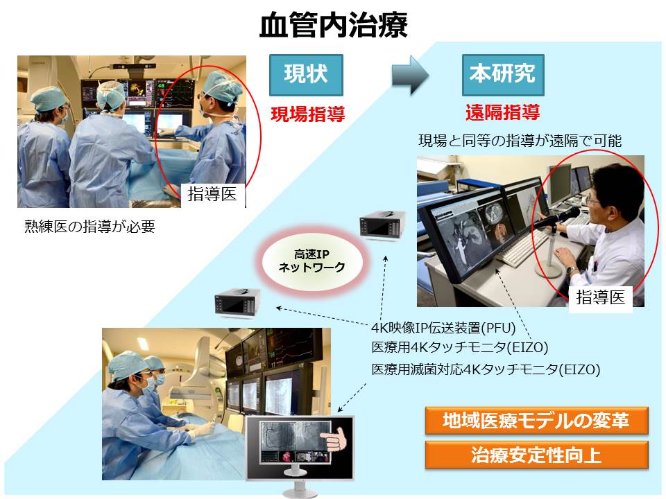 PFU/EIZO共同研究イメージ図