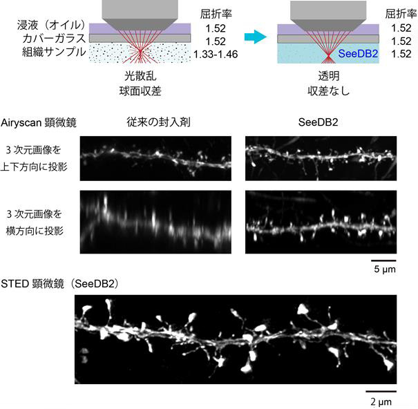 【SeeDB2の原理と2種類の超解像顕微鏡で撮影したマウス脳の樹状突起スパイン】