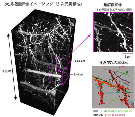 【マウス脳の神経回路の大規模超解像イメージング】