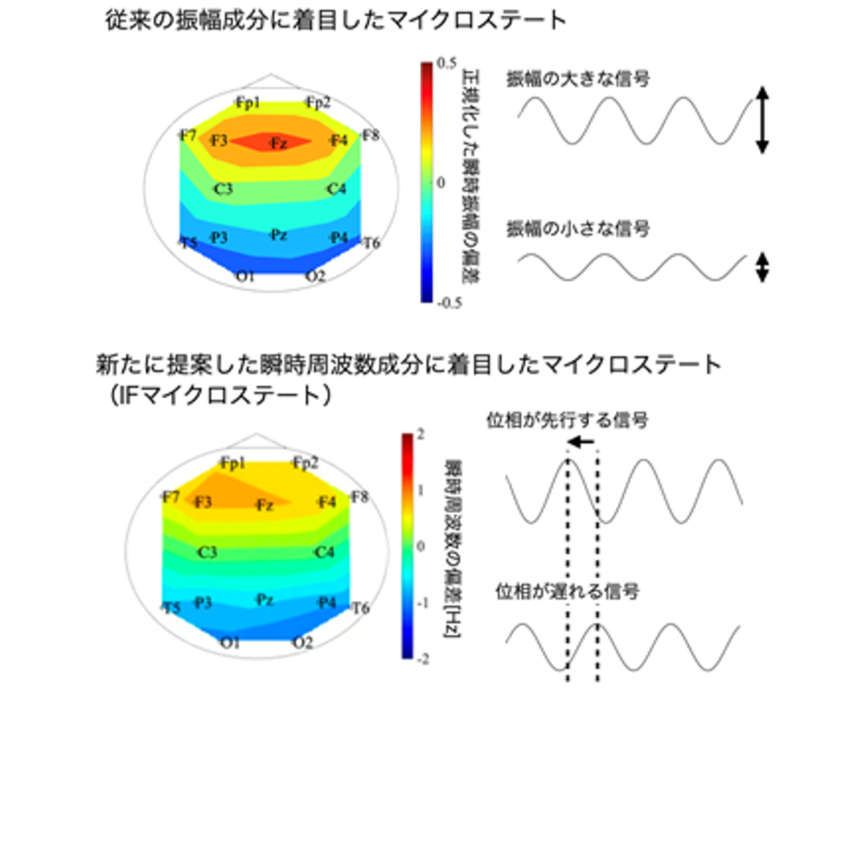 脳波の瞬時周波数によって特徴付けられるマイクロステートを新たに開発