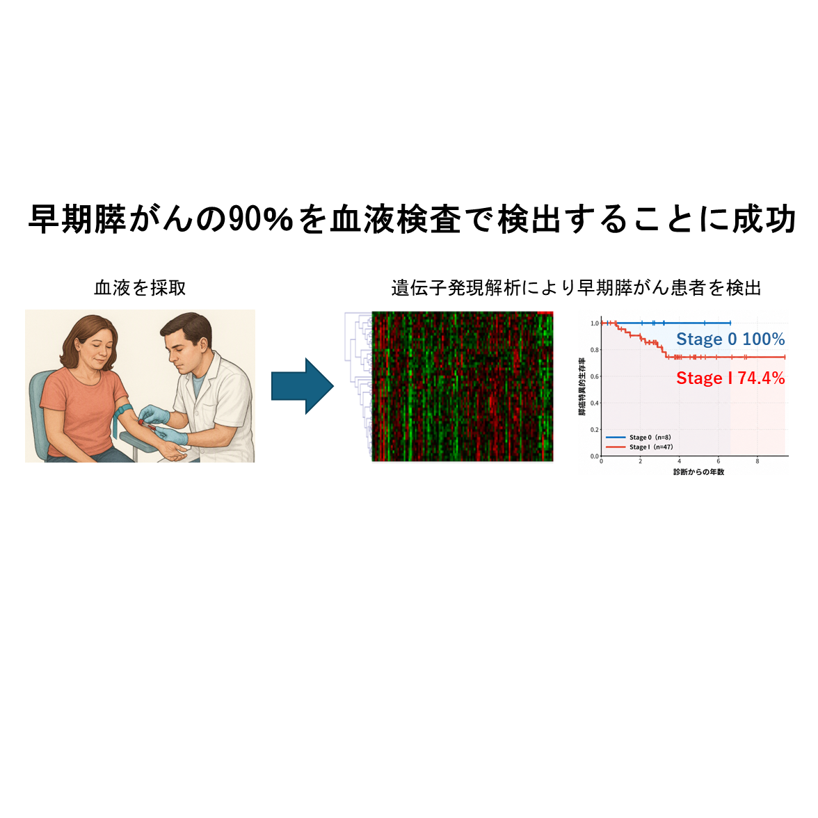 早期膵がんの90％を血液検査で検出することに成功 – 金沢大学